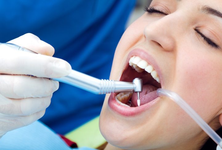 Root Canal Treatment